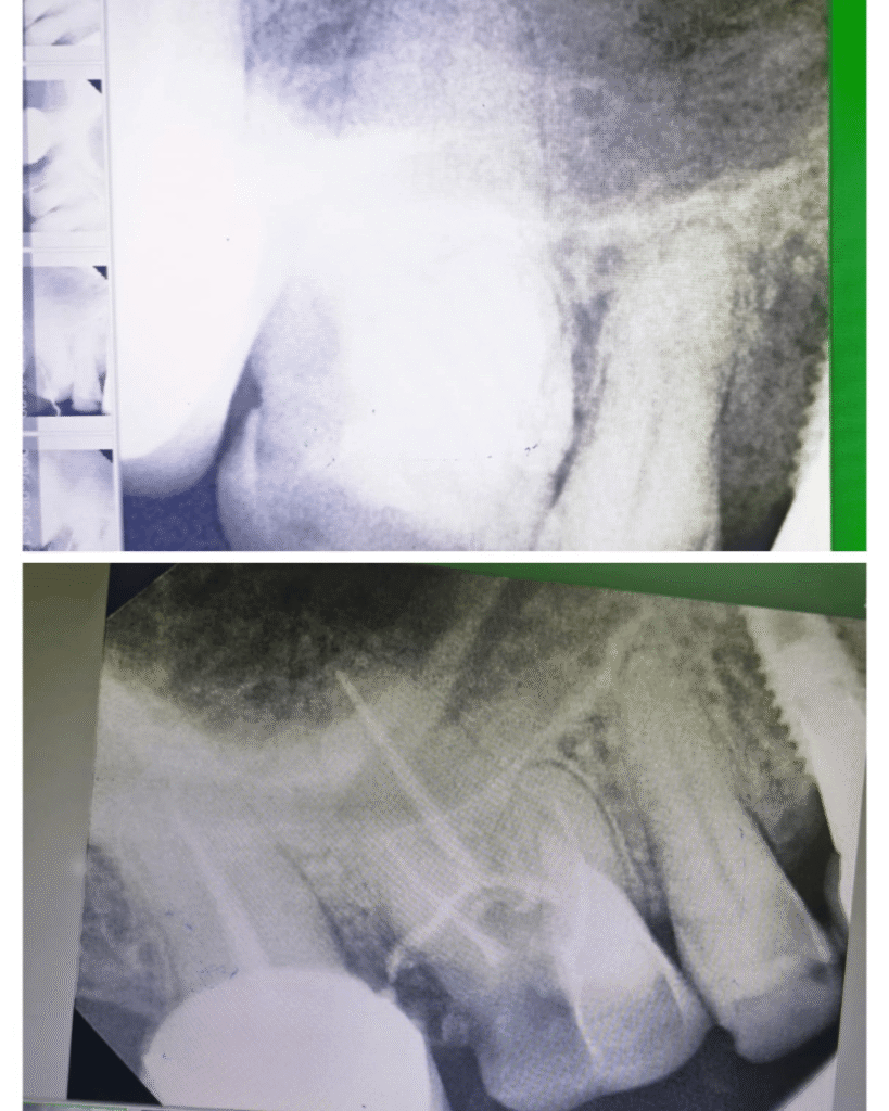 eraya dental care testiomonial 10