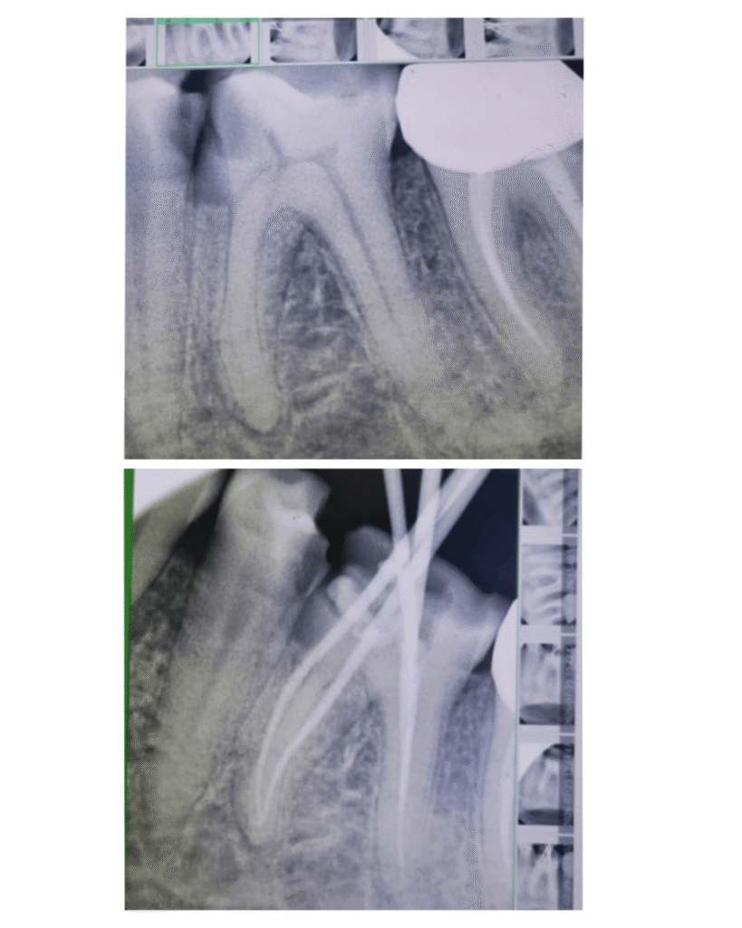 eraya dental care testiomonial 11