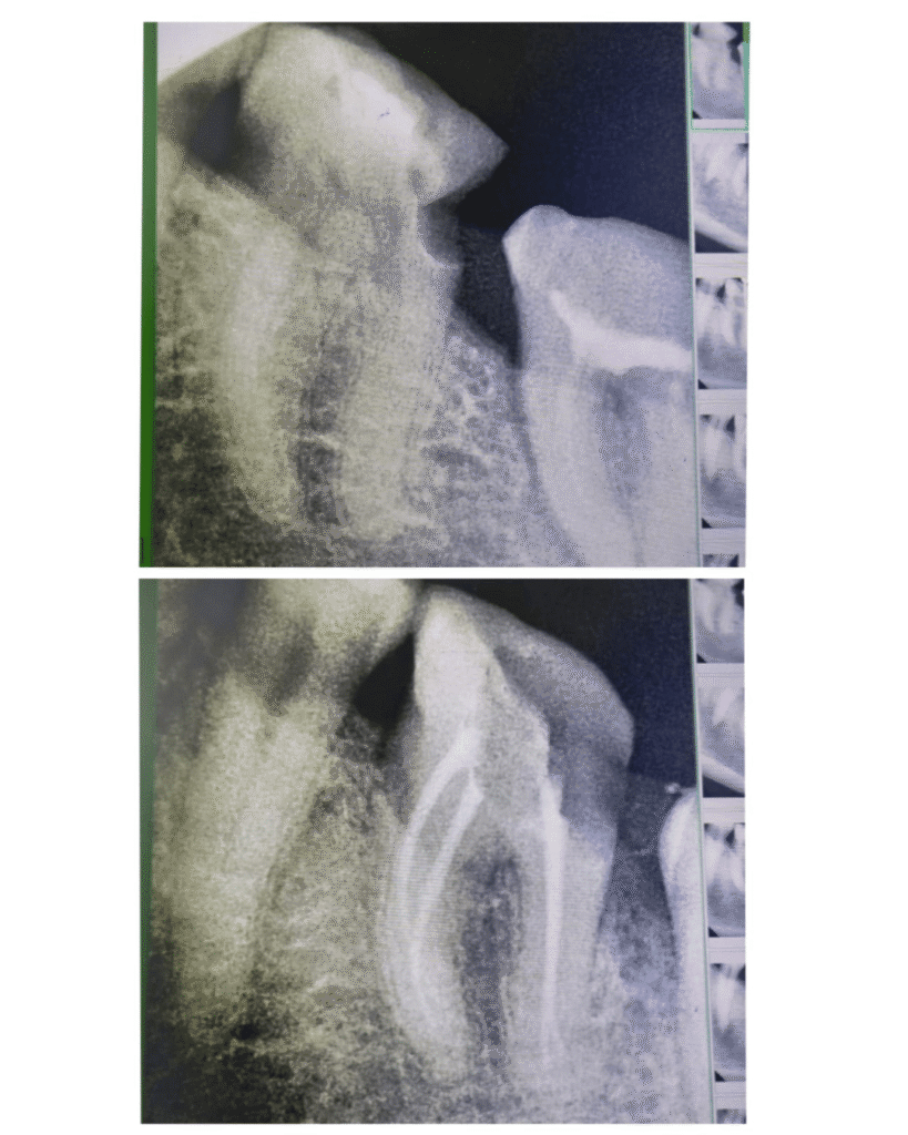 eraya dental care testiomonial 13