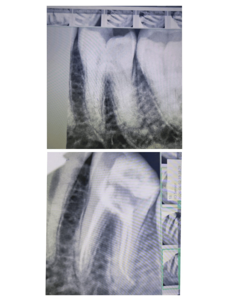 eraya dental care testiomonial 14