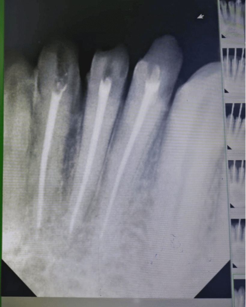 eraya dental care testiomonial 15