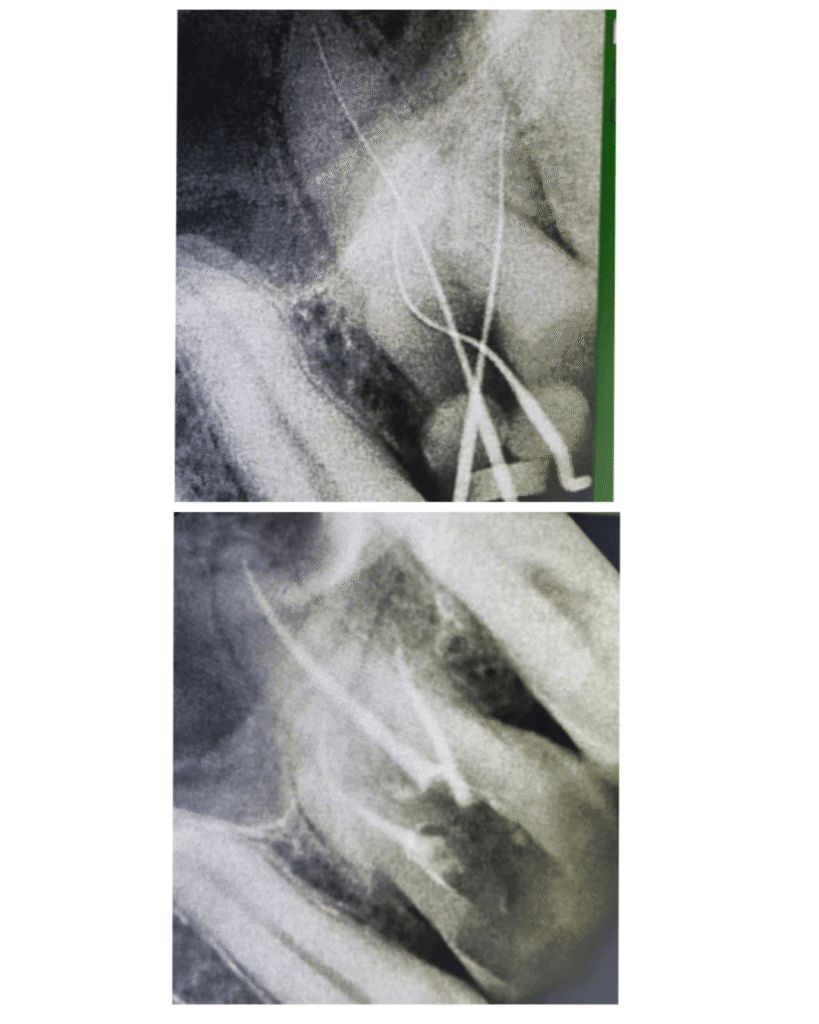 eraya dental care testiomonial 16
