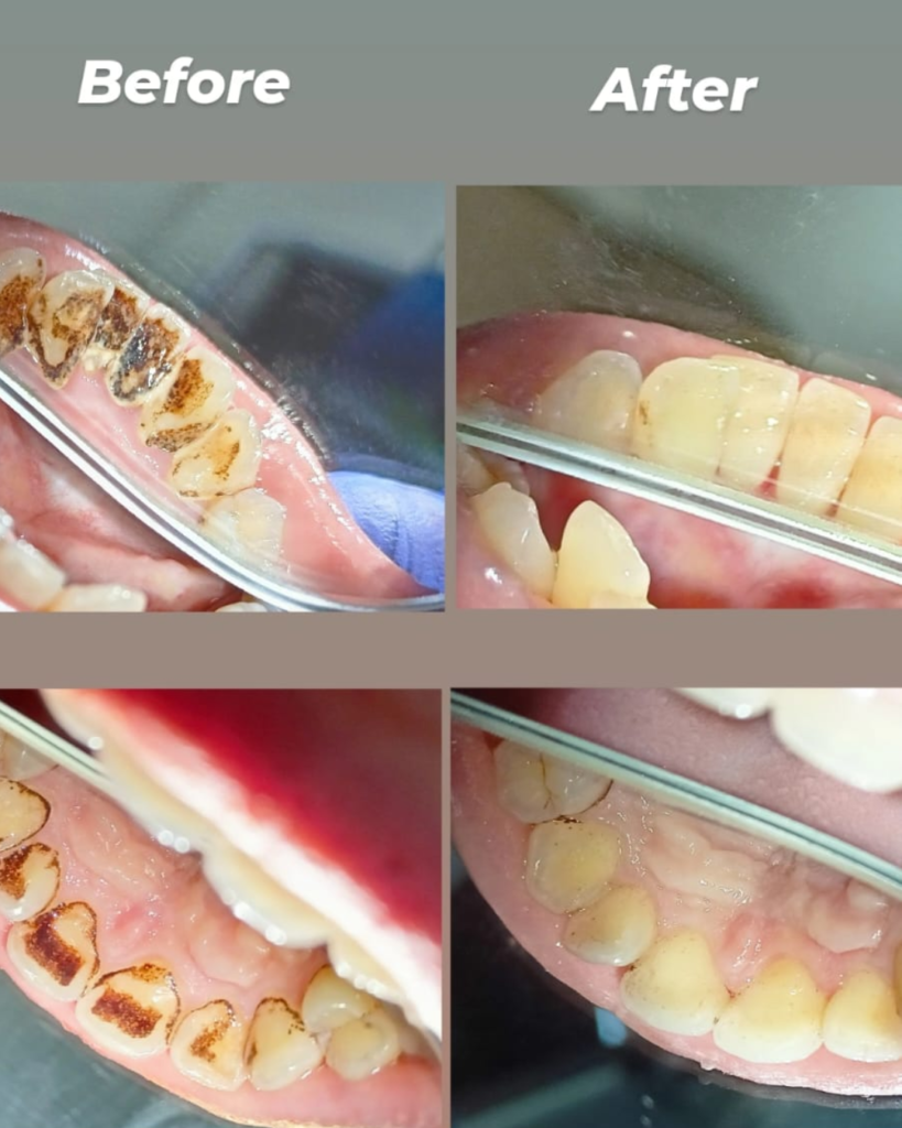 eraya dental care testiomonial 3