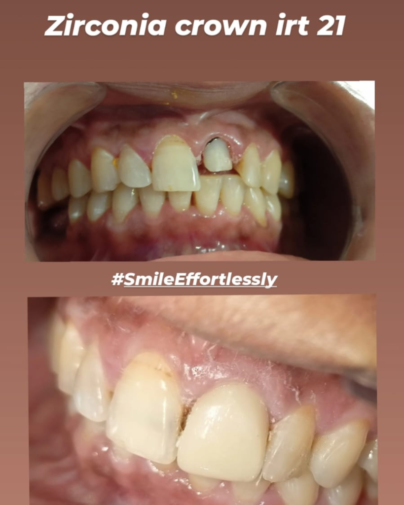 eraya dental care testiomonial 6