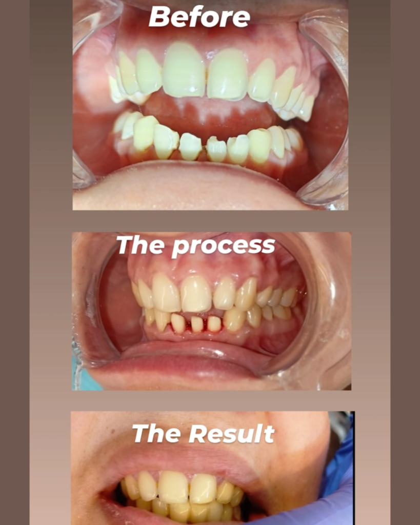 eraya dental care testiomonial 7