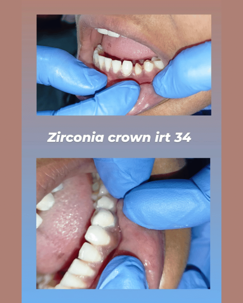 eraya dental care testiomonial 9